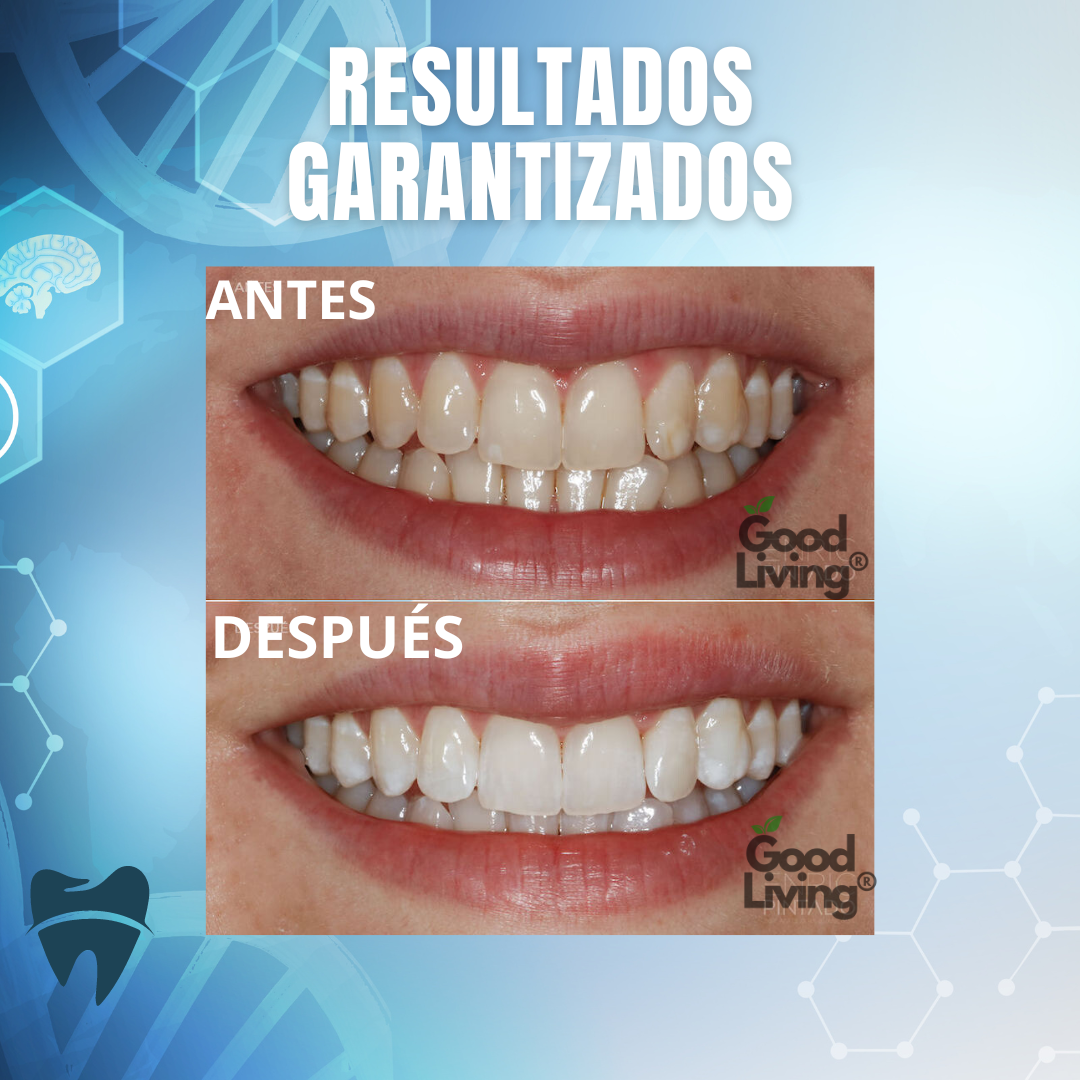 BLANQUEAMIENTO DENTAL + REGALO🎁[LÁPIZ BLANQUEAMIENTO INSTANTÁNEO]